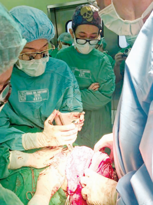 Orthognathic Surgery untuk Memperbaiki Rahang