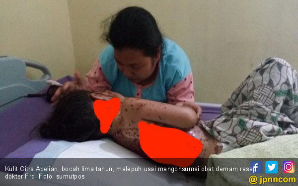 Astaga, Tubuh Bocah Ini Melepuh Usai Minum Obat Resep ...