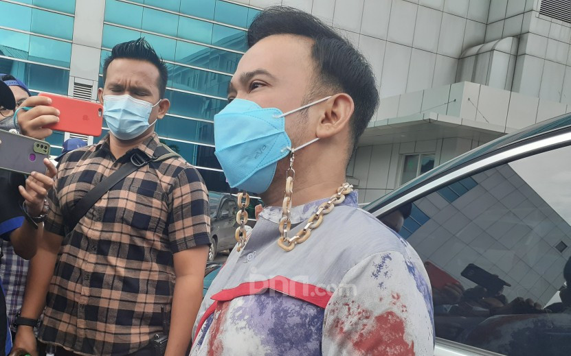 Ruben Onsu Ungkap Penyebab Dilarikan ke Rumah Sakit, Ada Hubungan dengan Darah - JPNN.com