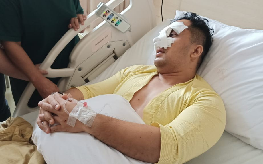 Jadi Korban Pengeroyokan, Perwira Polri Harus Operasi Hidung yang Patah - JPNN.com Banten