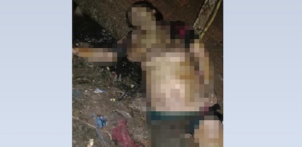 Kondisi Terkini Perempuan yang Dibakar Hidup-hidup di Sukabumi, Lihat Fotonya